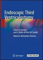 Endoscopic Third Ventriculostomy: Classic Concepts And A State-Of-The-Art Guide