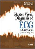 Master Visual Diagnosis Of Ecg: A Short Atlas (Learn Ecg Through Ecg)