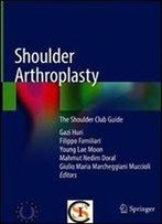 Shoulder Arthroplasty: The Shoulder Club Guide