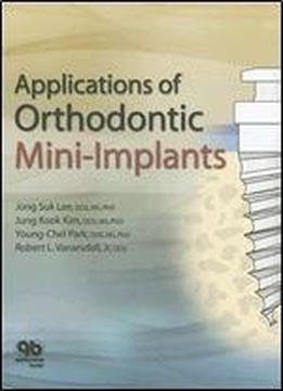 Applications Of Orthodontic Mini Implants