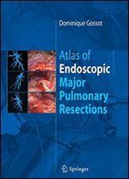 Atlas Of Endoscopic Major Pulmonary Resections
