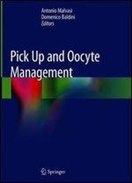 Pick Up And Oocyte Management