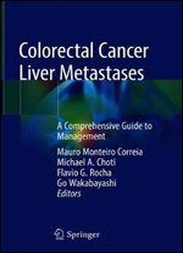 Colorectal Cancer Liver Metastases: A Comprehensive Guide To Management