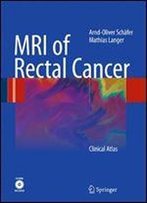 Mri Of Rectal Cancer: Clinical Atlas