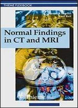 Normal Findings In Ct And Mri