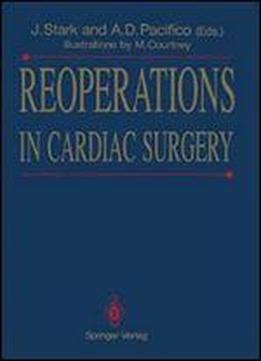 Reoperations In Cardiac Surgery