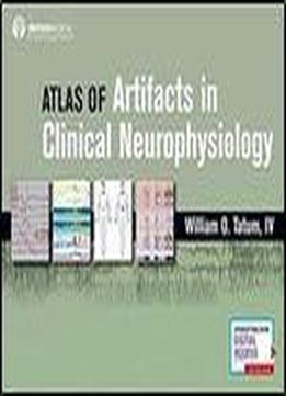 Atlas Of Artifacts In Clinical Neurophysiology