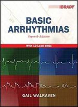 Basic Arrhythmias