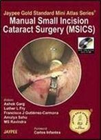 Manual Of Small Incision Cataract Surgery
