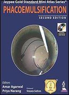 Phacoemulsification (2nd Edition)