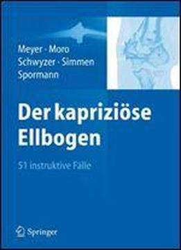 Der Kapriziose Ellbogen: 51 Instruktive Falle