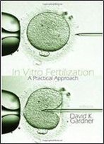 In Vitro Fertilization: A Practical Approach