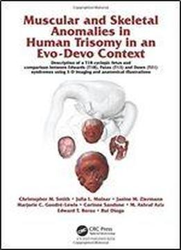 Muscular And Skeletal Anomalies In Human Trisomy In An Evo-devo Context: Description Of A T18 Cyclopic Fetus And Comparison Between Edwards (t18), ... 3-d Imaging And Anatomical Illustrations
