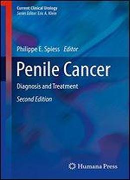 Penile Cancer: Diagnosis And Treatment (current Clinical Urology)