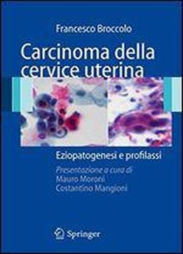 Carcinoma Della Cervice Uterina: Eziopatogenesi E Profilassi