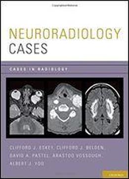 Neuroradiology Cases