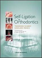 Self-Ligation In Orthodontics