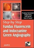 Step By Step Fundus Fluorescein And Indocyanine Green Angiography