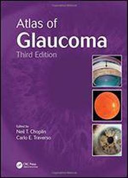 Atlas Of Glaucoma, Third Edition