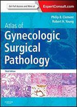 Atlas Of Gynecologic Surgical Pathology: Expert Consult: Online And Print