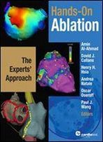 Hands-On Ablation: The Experts' Approach