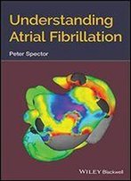 Understanding Atrial Fibrillation: A Conceptually Guided Approach