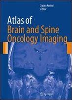 Atlas Of Brain And Spine Oncology Imaging (Atlas Of Oncology Imaging)
