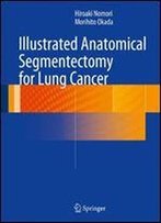 Illustrated Anatomical Segmentectomy For Lung Cancer