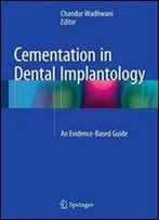 Cementation In Dental Implantology: An Evidence-Based Guide