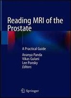 Reading Mri Of The Prostate: A Practical Guide