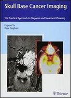 Skull Base Cancer Imaging: The Practical Approach To Diagnosis And Treatment Planning