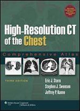 High-resolution Ct Of The Chest: Comprehensive Atlas