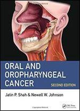 Oral And Oropharyngeal Cancer