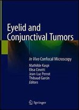 Eyelid And Conjunctival Tumors: In Vivo Confocal Microscopy