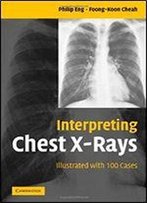 Interpreting Chest X-Rays: Illustrated With 100 Cases