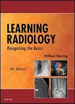 Learning Radiology: Recognizing The Basics