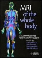 Mri Of The Whole Body: An Illustrated Guide To Common Pathologies
