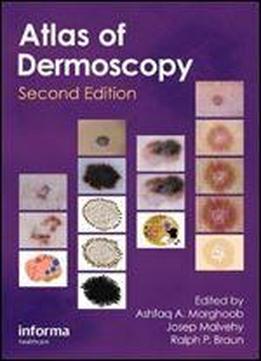 An Atlas Of Dermoscopy (2nd Edition)