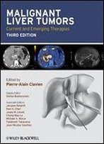 Malignant Liver Tumors: Current And Emerging Therapies